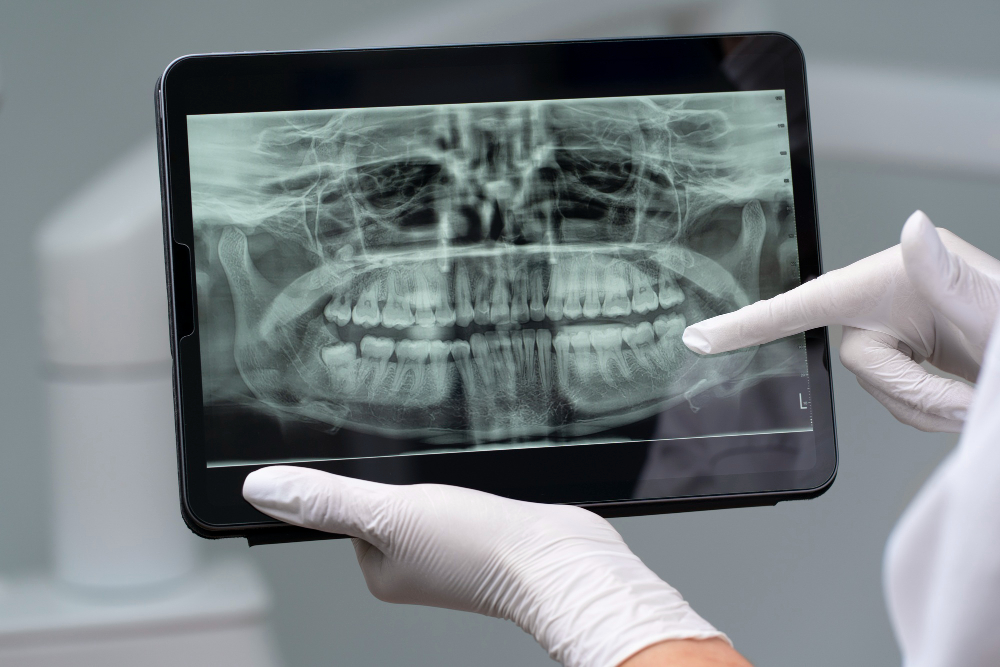 Digital X-Rays  Bolingbrook, IL